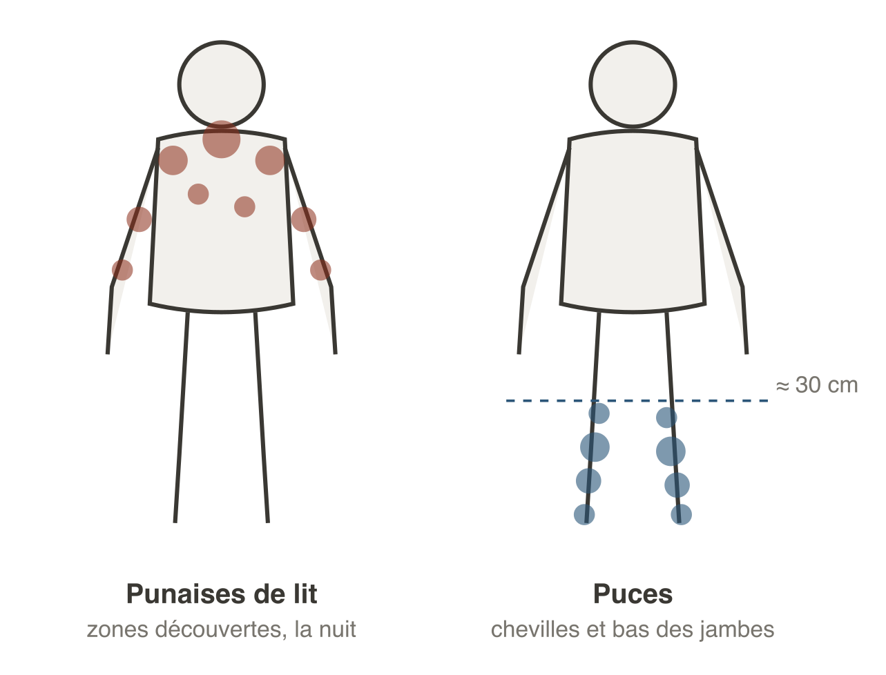 Comparaison des zones de piqûres : les punaises de lit piquent les zones découvertes pendant le sommeil, bras, épaules, nuque et haut du dos ; les puces piquent les chevilles et le bas des jambes, car elles vivent au sol et sautent rarement au-delà de trente centimètres.